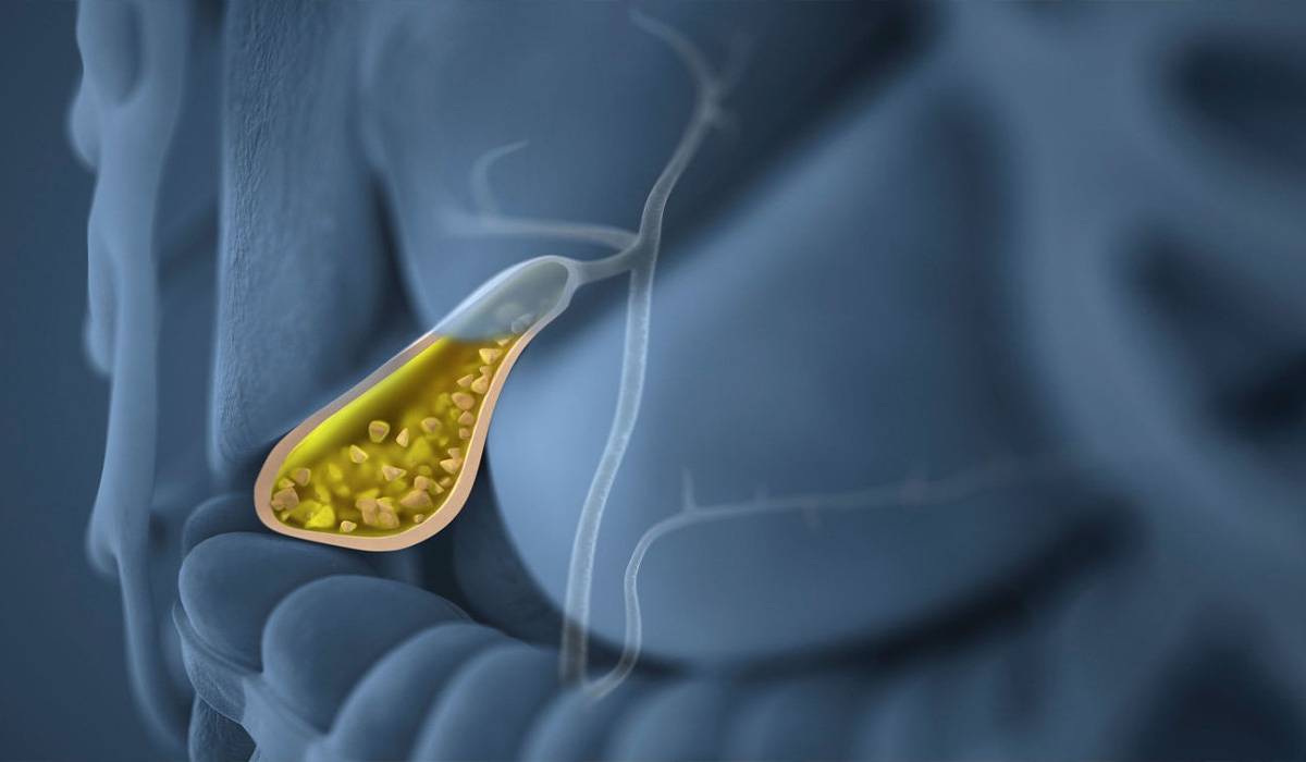 Як ендоскопія допомагає у діагностиці раку жовчного міхура?