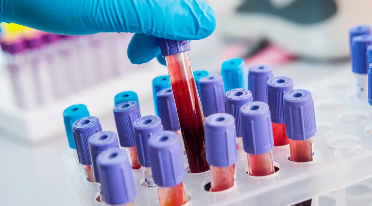 Коли призначають аналіз на реактивний білок і що він показує