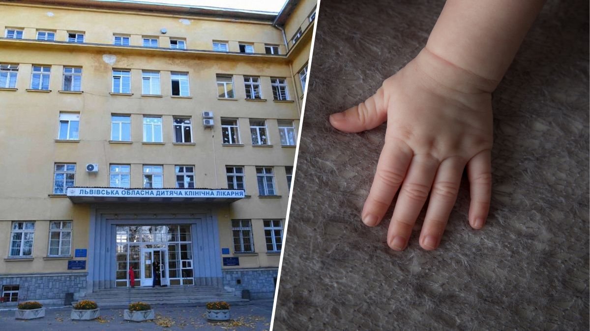 У Львові врятували однорічну дівчинку, яка ледь не померла після вдихнення арахісу — лікарі провели надскладну операцію