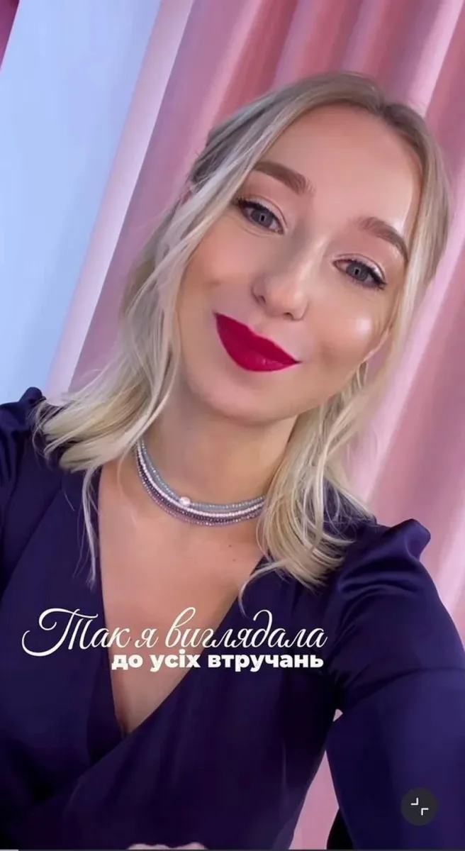 Катерина Реп’яхова до операцій